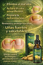 🔥2x1 EN UÑAS MÁS FUERTES Y SALUDABLES🔥